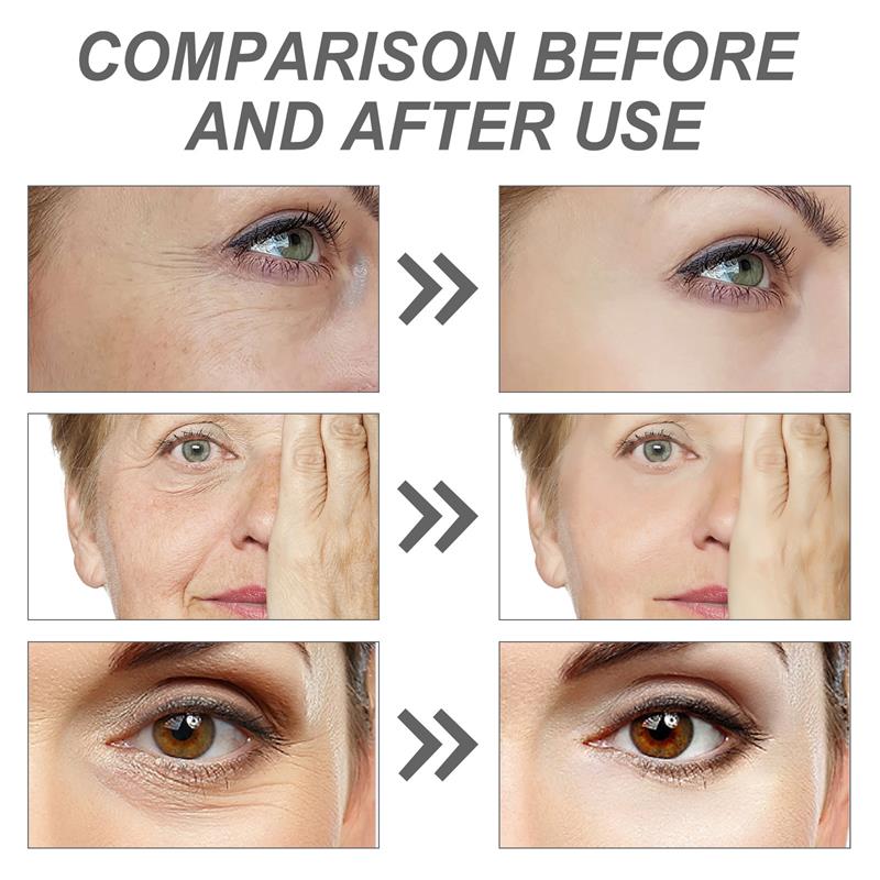 Retinol Remove Wrinkle Face Se - đánh giá và giá Milk Thistle Silymarin