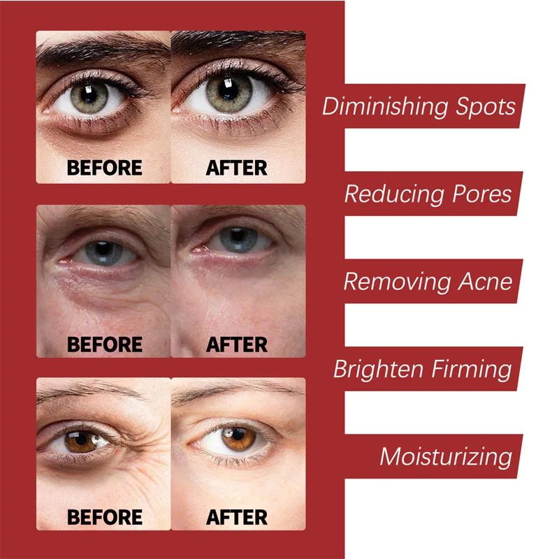 Retinol Cream  Moisturizing Sk - đánh giá và giá Milk Thistle Silymarin