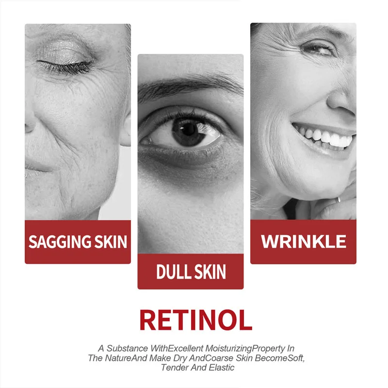 Retinol Cream  Moisturizing Sk - đánh giá và giá Milk Thistle Silymarin